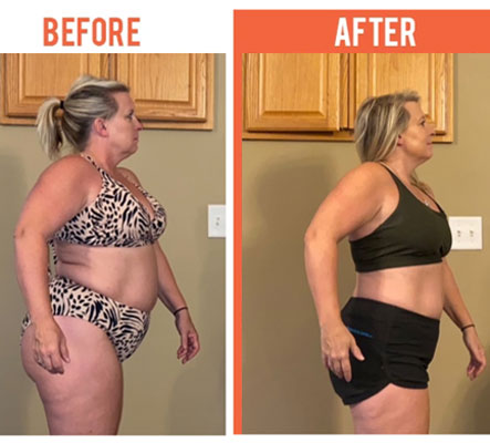 Weight Loss Plymouth MN Before and After